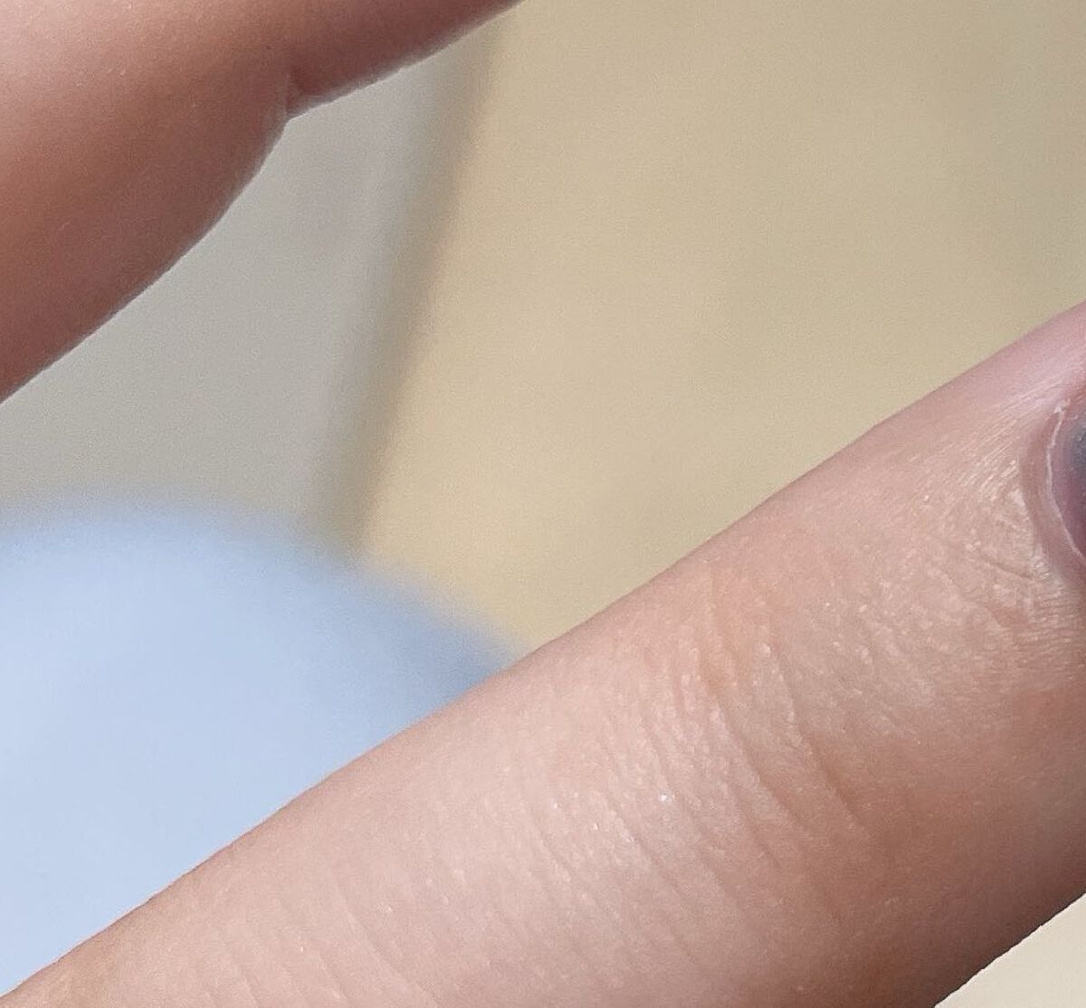 病院で看護師に「あらかわいい笑」と言われたネイル→まさかのデザインに「え？本物？」「初めて見た」と1100万表示 | 美容 ねとらぼ