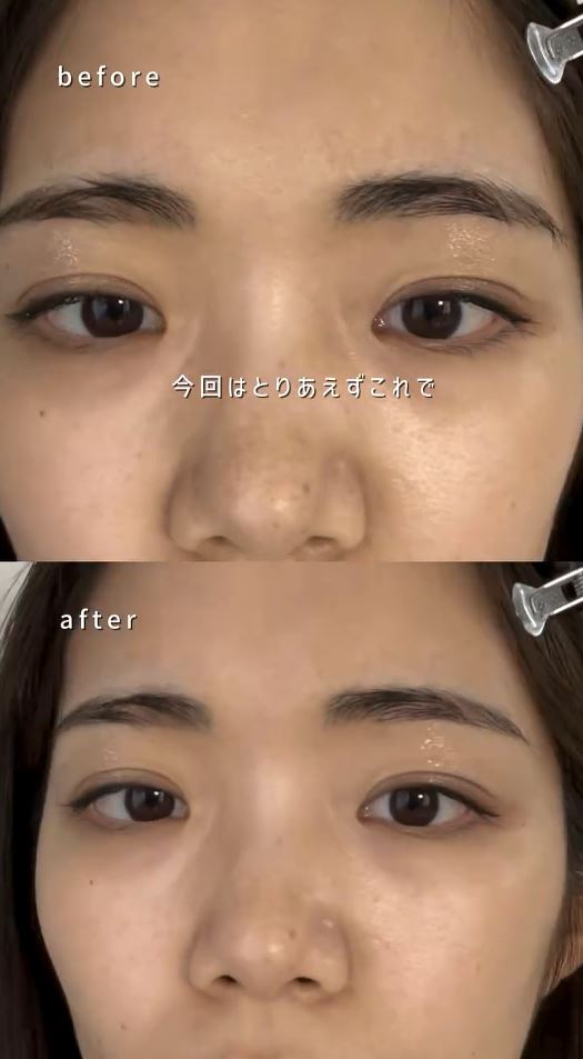 カットビフォーアフター