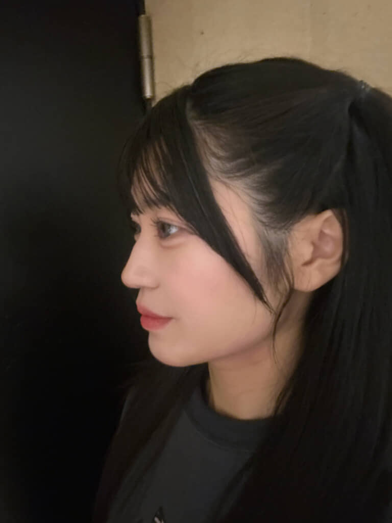 アフター（22歳現在）