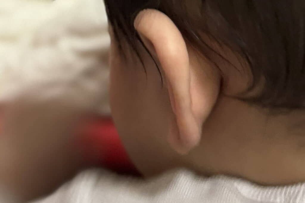 赤ちゃんの髪の毛を見てみたら……