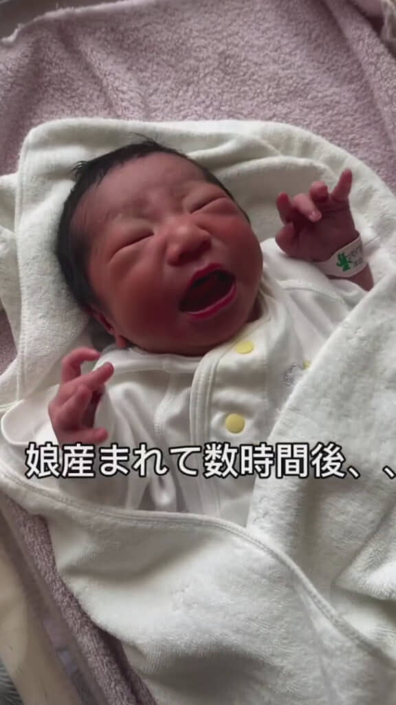 少しむくみが気になる