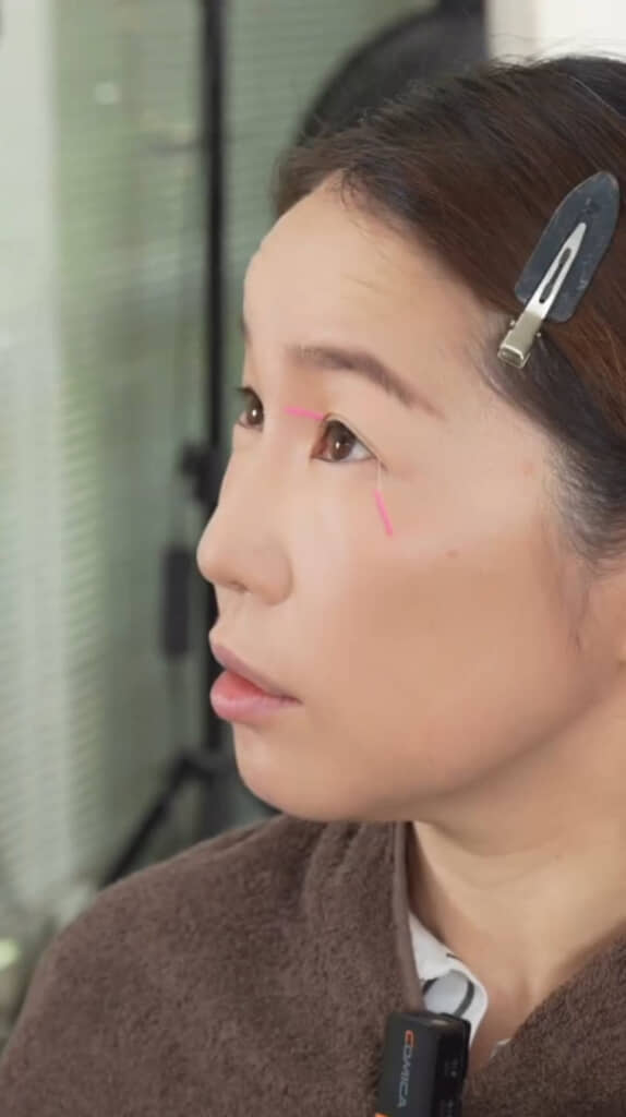 左右のバランスなどを見ながら慎重にアイテープをつけています