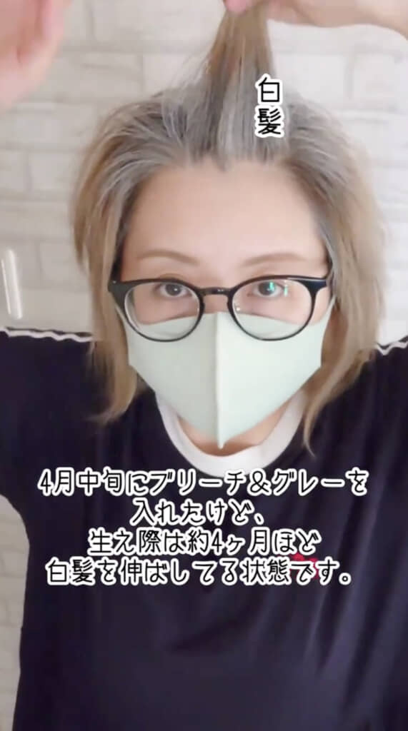 移行開始して1カ月、生え際は4カ月伸ばした状態
