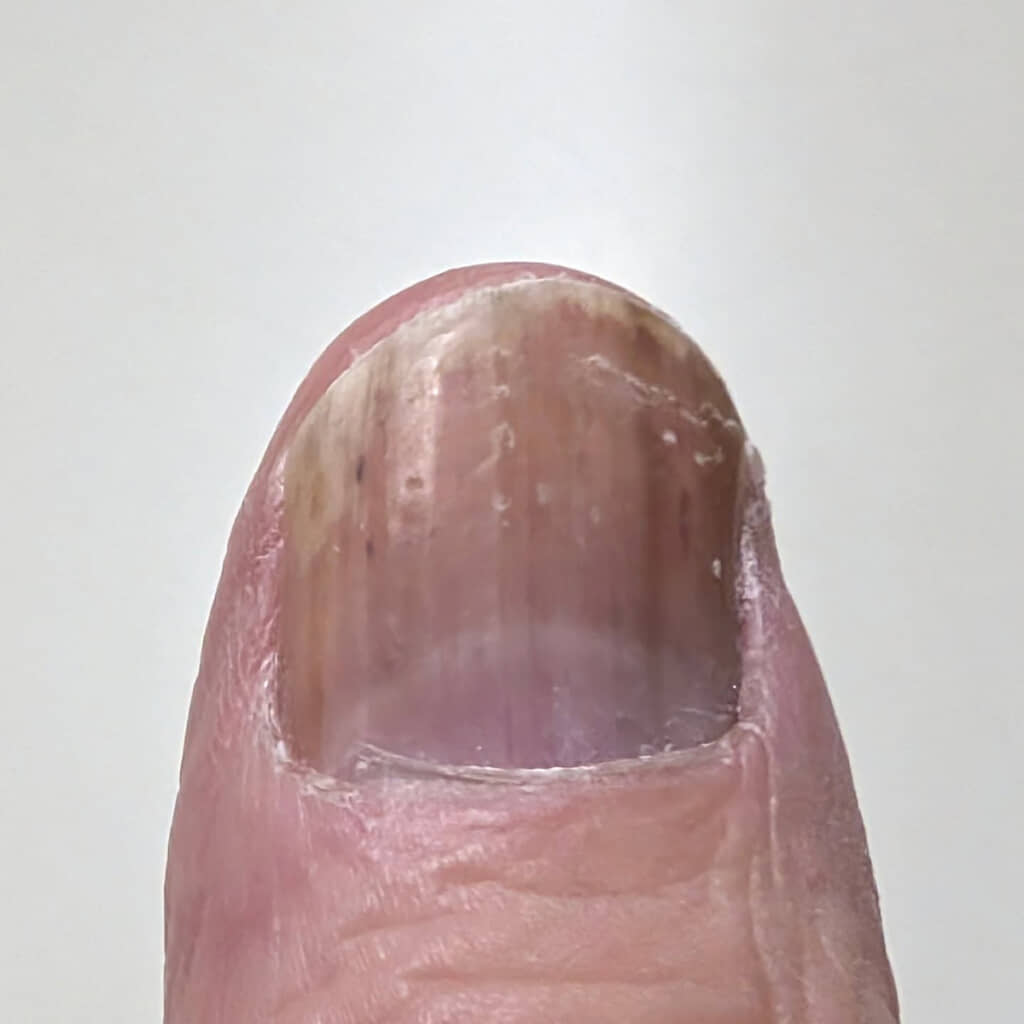 30年ぶりにまっすぐ生えた……！