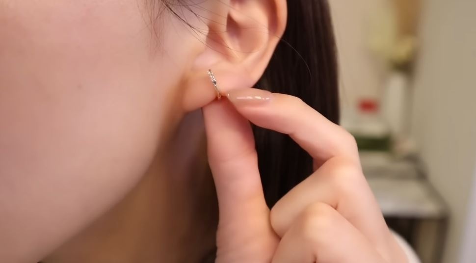 食い込んでしまった状態