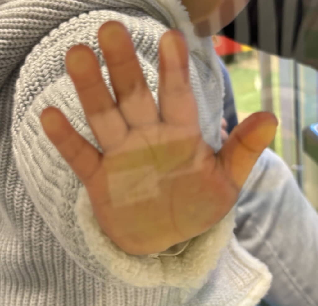 ただでさえかわいいこのおてては……