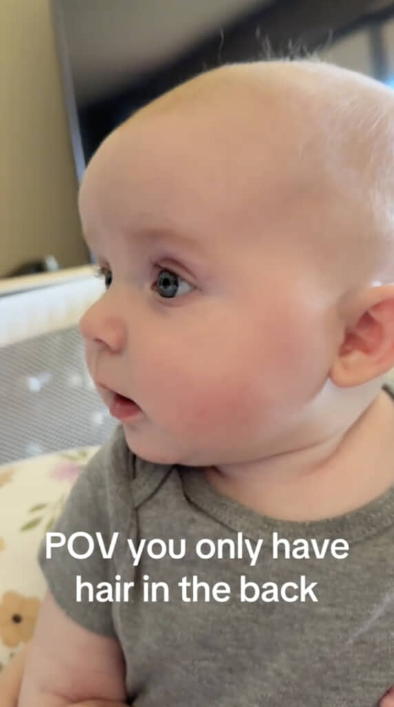 ぽやぽやの産毛のような髪しか生えていないように見えますが……