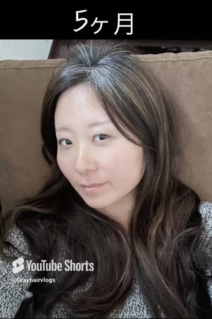 だんだん白髪が目立つように（5カ月目）