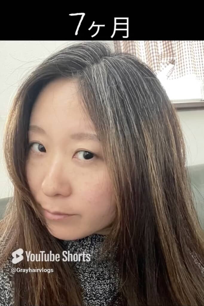 髪全体に白髪が混じるように（7カ月目）