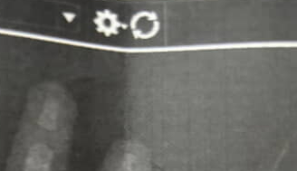 1歳息子の“レントゲン”を見たママ、思わず……　衝撃の光景に「スゴすぎて草」「初めて見ました」（1/3） | 育児 ねとらぼ