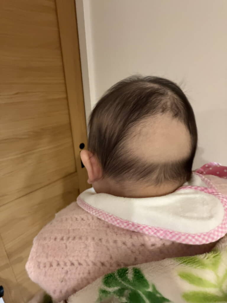 一部がつるんとハゲていました！