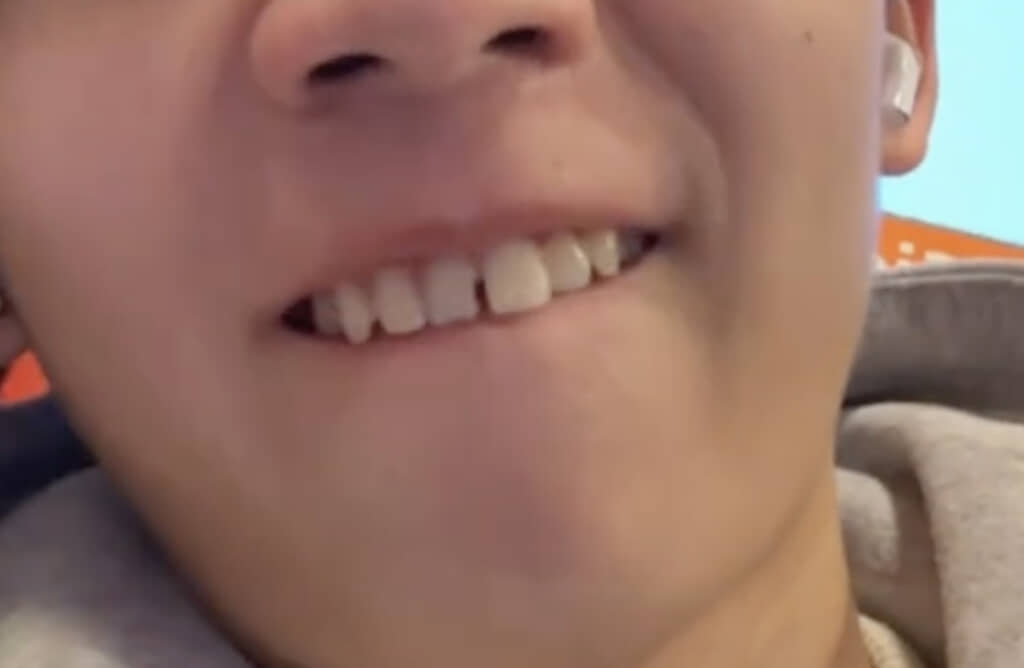 見事に隙間が空いています