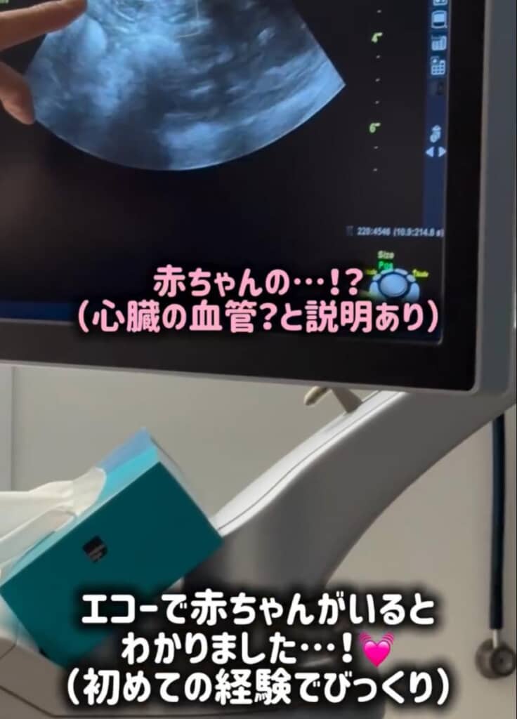 予想通り赤ちゃんがいることが分かりました