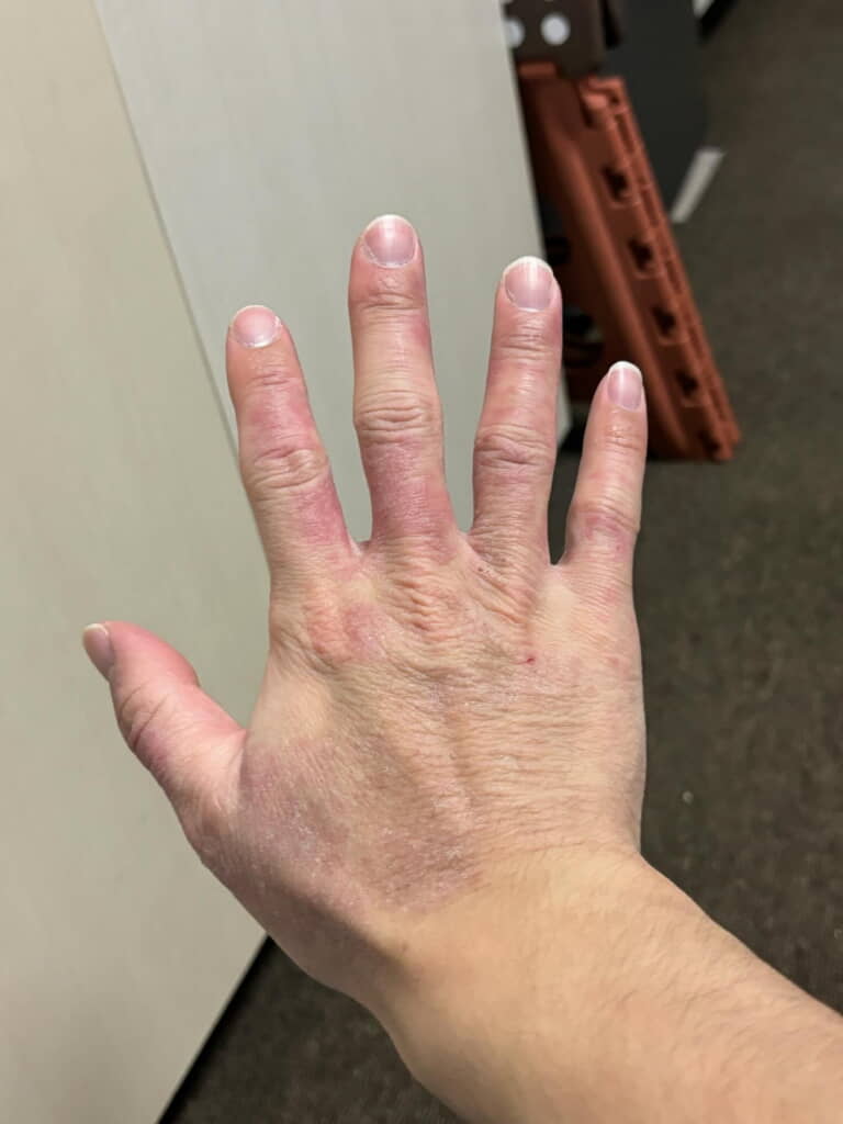 この手に助けられた人はどれだけいることでしょう