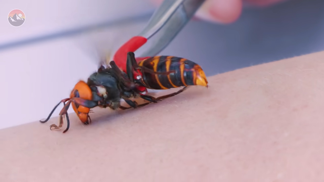 オオスズメバチに刺された直後→左腕がとんでもないことに……　「もはやレベルが違う」「死ななくて良かった」と340万再生【海外】 | その他生き物 ねとらぼ
