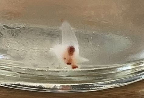 実は超偏食なクリオネ