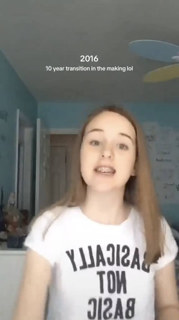 12歳のころのemilyさん。よく見ると前歯には歯列矯正のワイヤーが