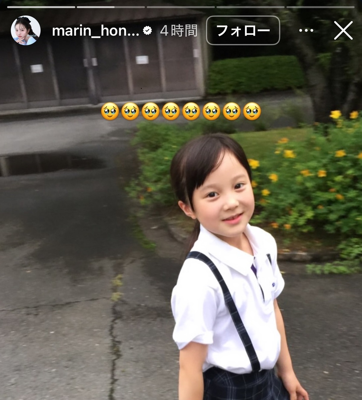 天使のような笑顔の妹が高校生に→卒業式のまさかの姿にSNS驚き「まじか」「家庭環境も遺伝子も強すぎる」【本田真凜・本田紗来】（1/3） | エンタメ ねとらぼ