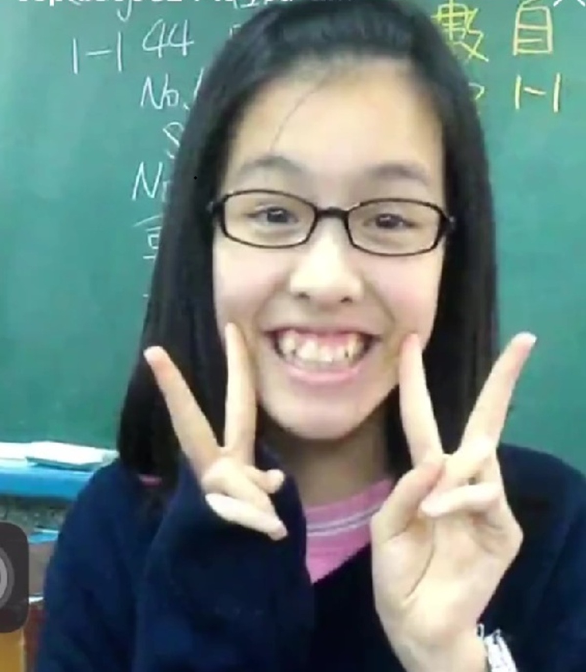 子どものころ「馬づら」「出っ歯」とあだ名をつけられた女の子→大人になった現在に「勇気もらった」「女優さんみたい」 【海外】(1/3) | 美容 ねとらぼ