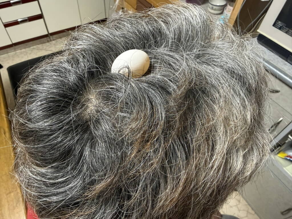 頭の上に卵が……!!!!