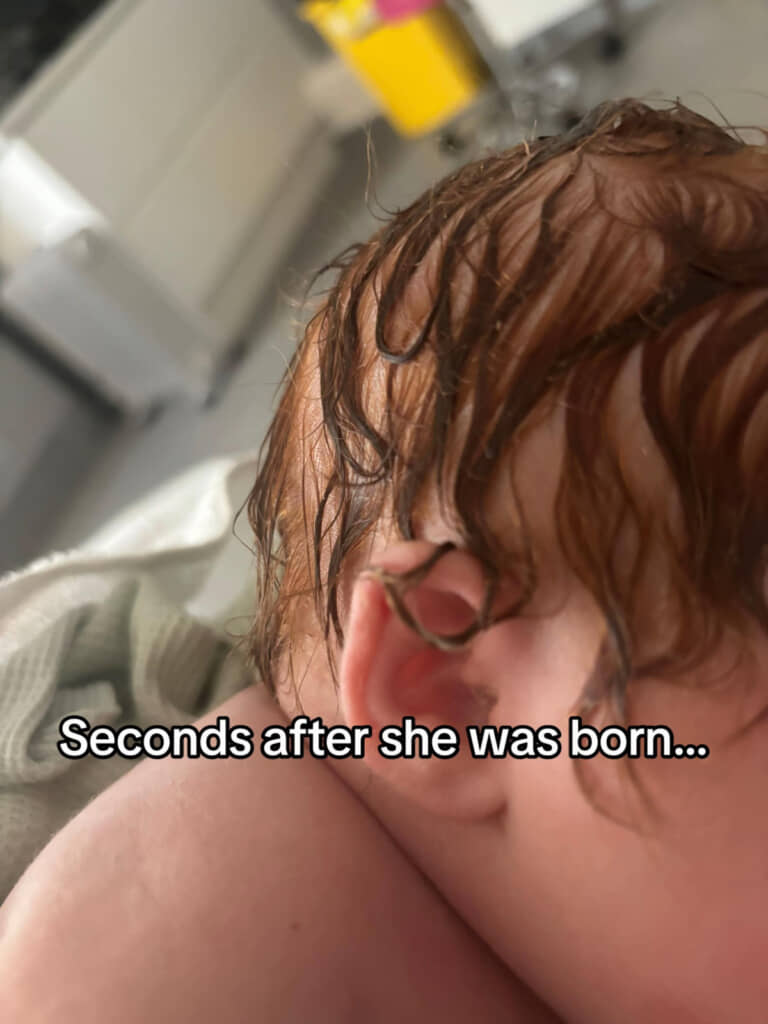 生まれたばかりのころの髪の毛の様子