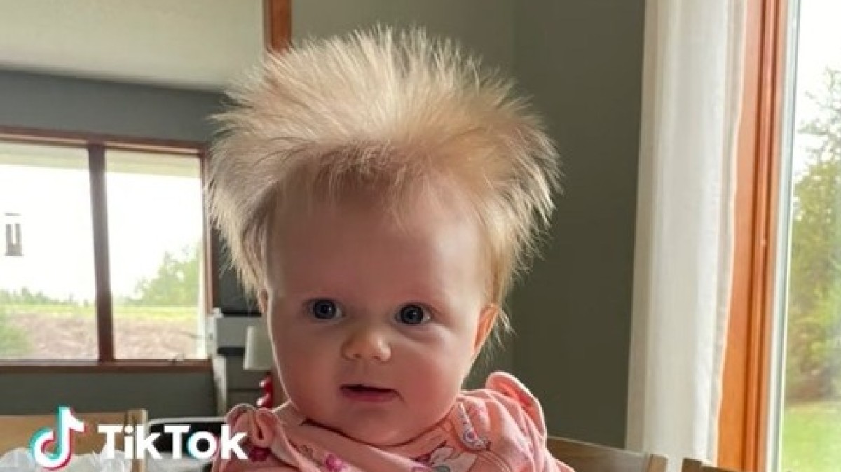 ワイルドな“爆発ヘア”だった赤ちゃん→3年後……　目を見張る“現在の姿”に「こんなの見たことない」「私もそうだった！」【海外】（1/2） | ライフスタイル ねとらぼ