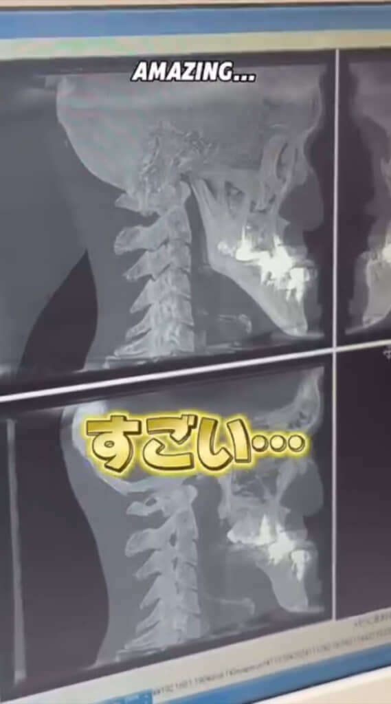 城之内さん本人もびっくり