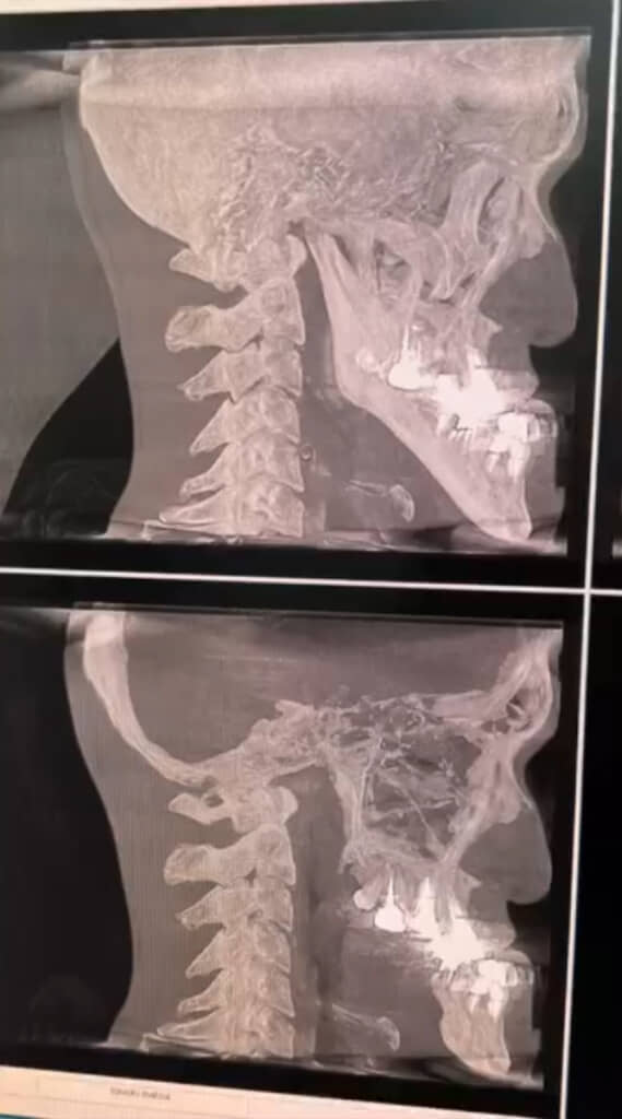 話題になったレントゲン写真