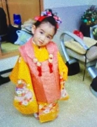 小さな雛美さん（ビフォー）