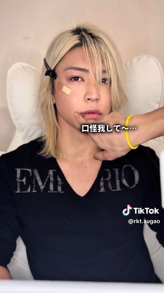 口元のケガも再現