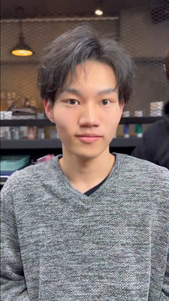 アフター（施術後）