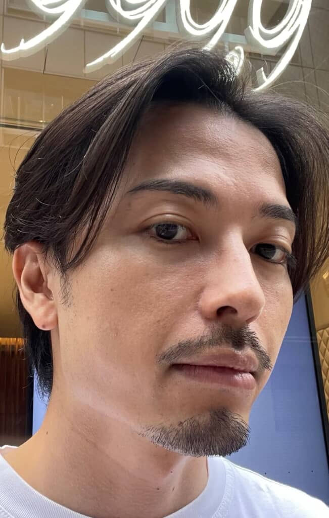 スキンケアを変える前の肌