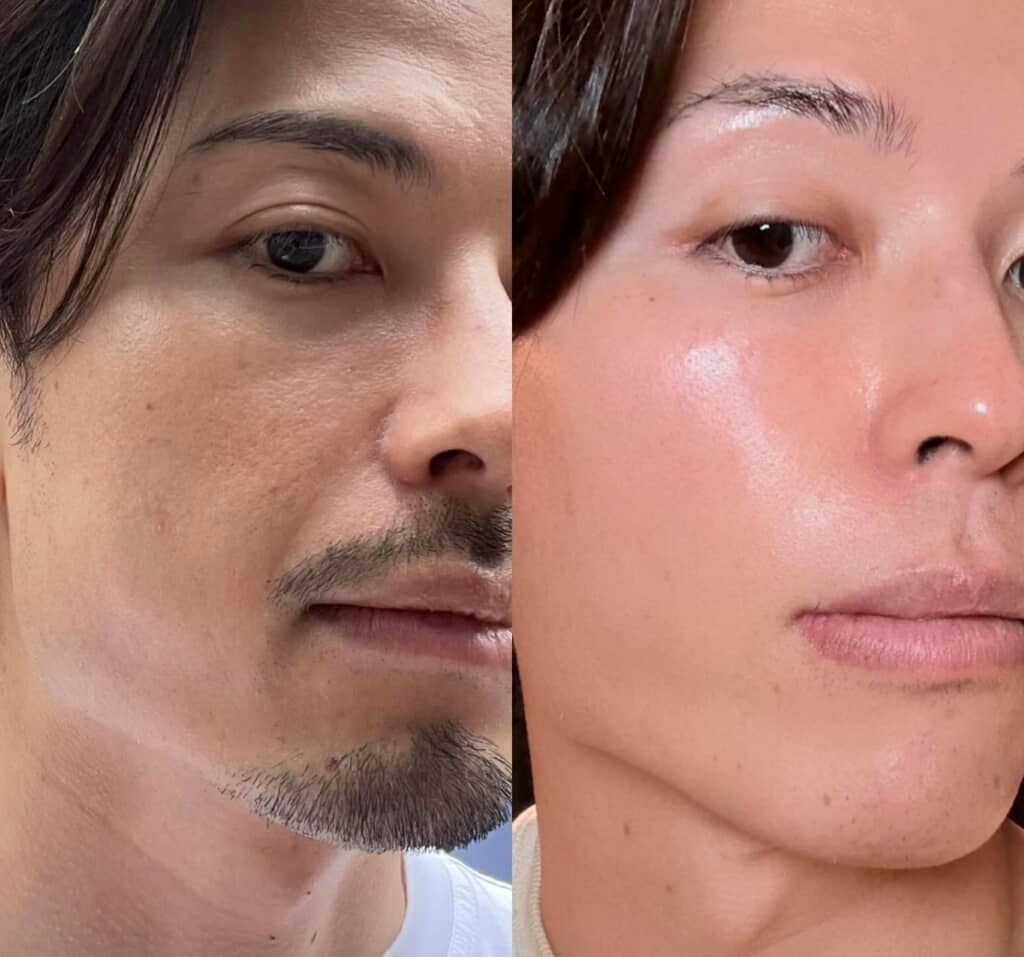 比較してみると変化が一目瞭然！