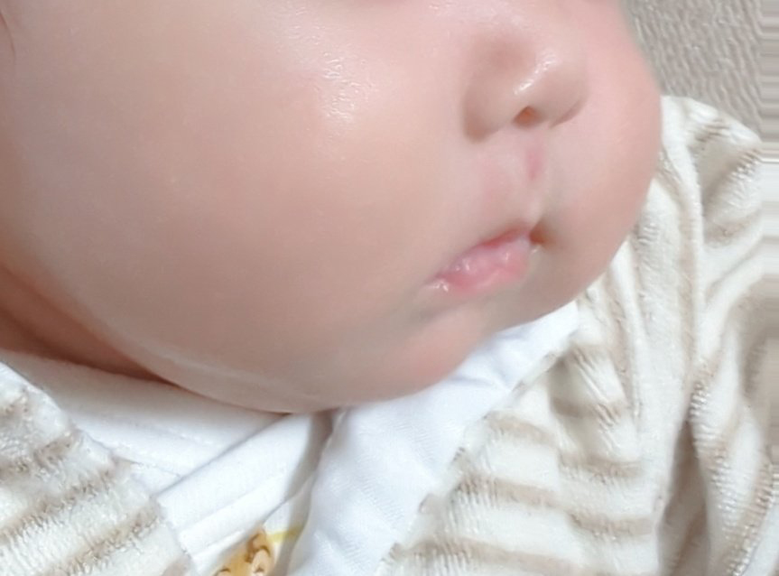 生後1カ月赤ちゃんのぷくぷくほっぺ
