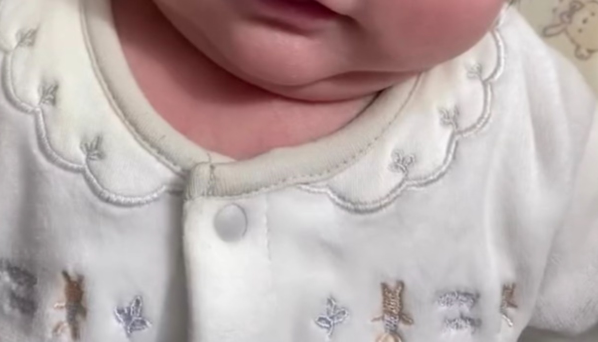 生後3カ月の次男が病院へ→先生「ライオンキングだね」 納得の姿に「まぁ立派な」「ちょっと待って可愛すぎる」(1/3) | 育児 ねとらぼ