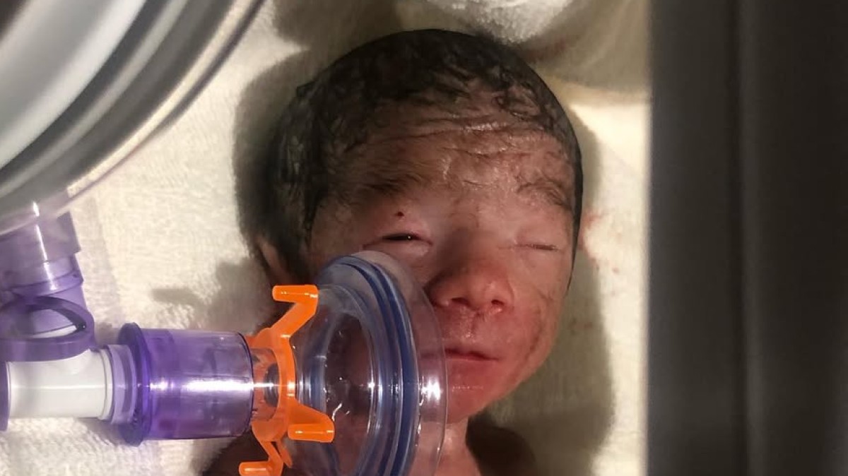 妊娠29週1000グラムで生まれた次男→「一生寝たきりかも」といわれて6年後……　“現在の姿”に「最高の息子」「生まれてきてくれてありがとう」（1/2） | ライフスタイル ねとらぼ