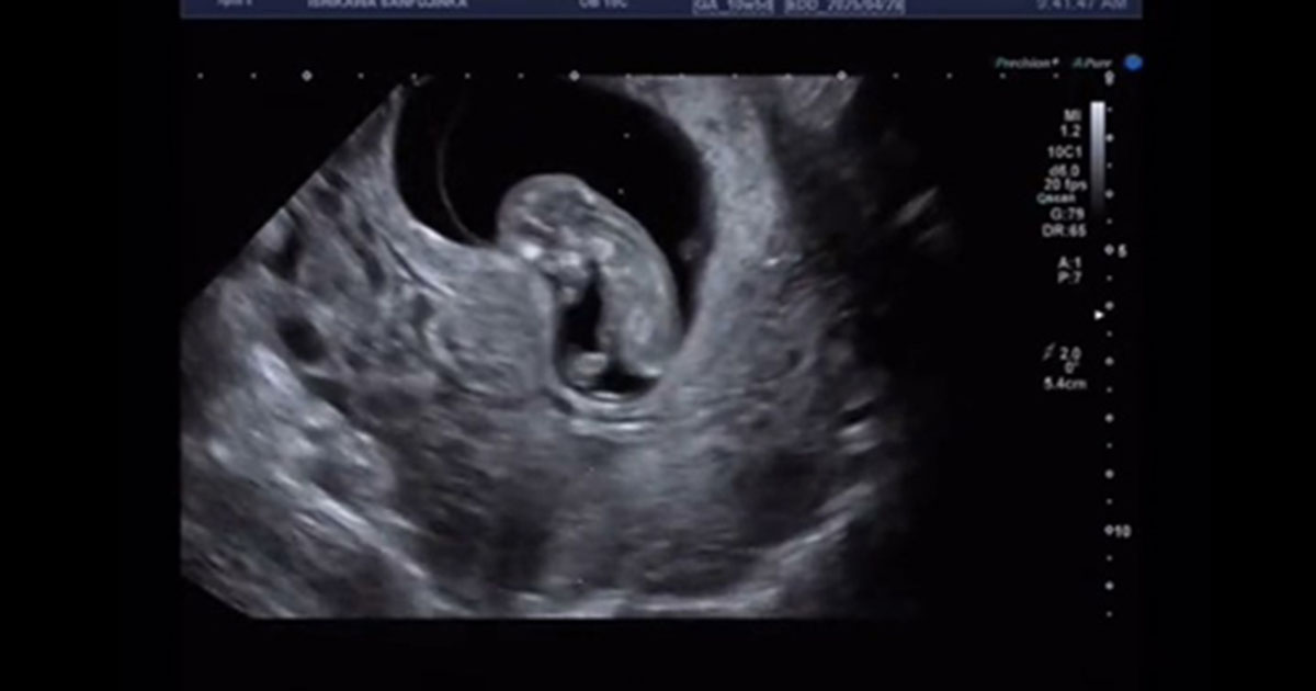 おなかの中で元気すぎて「CGじゃない？」とバズった次女→生後11カ月で……　現在の姿に「なんじゃこりゃ!!」「人間って天使産めるんだ」（1/2） | 育児 ねとらぼ