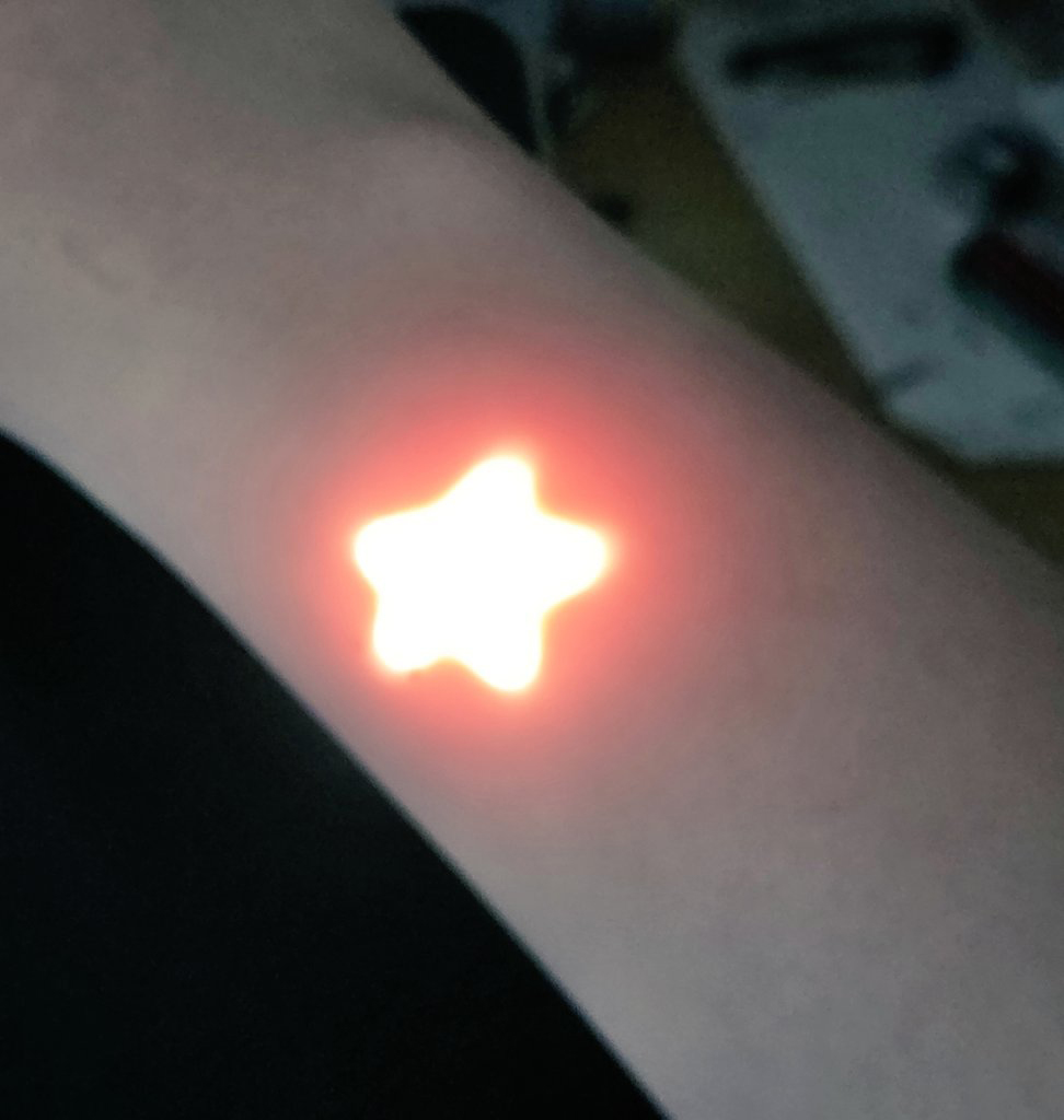 カーテンを通過した“光”がアザのようにッ……！