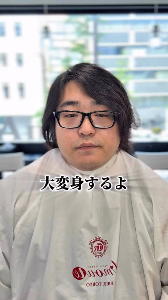 脱毛症に悩む男性（ビフォー）