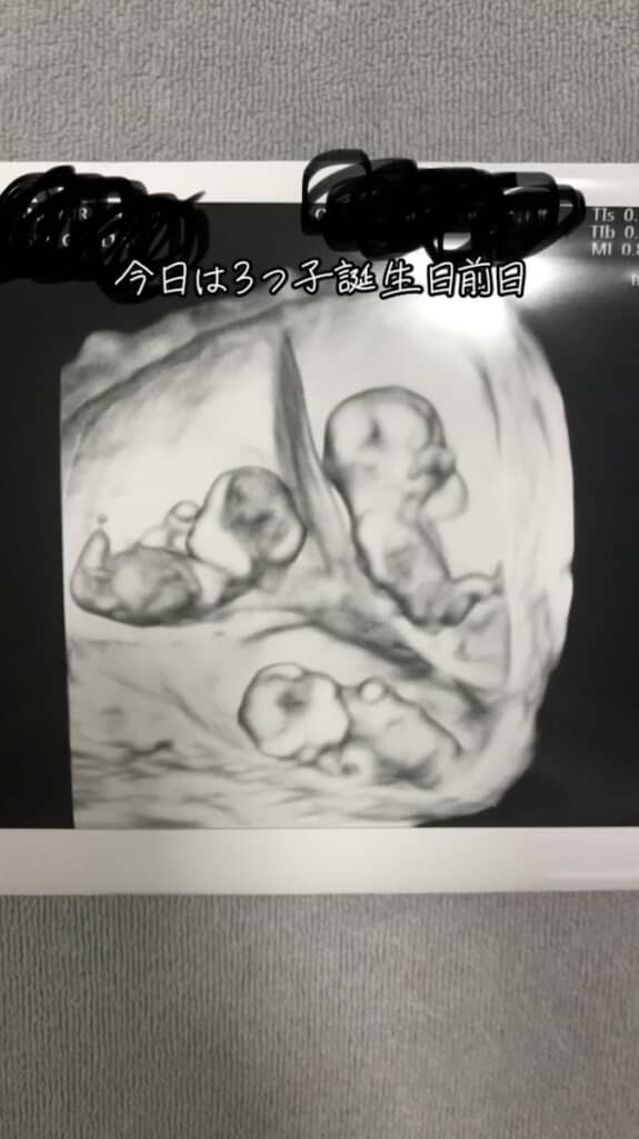 ママのお腹に宿った三つ子の赤ちゃん