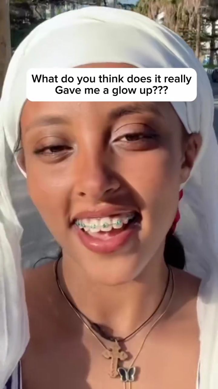 歯並びが整い垢抜けた印象の投稿者さん