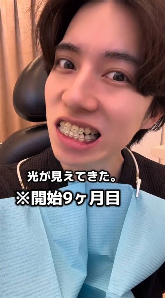 「がんこちゃん」と呼ばれた男性の歯列矯正