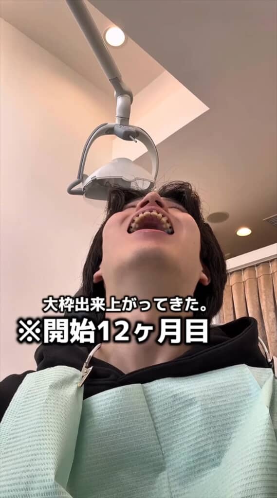「がんこちゃん」と呼ばれた男性の歯列矯正