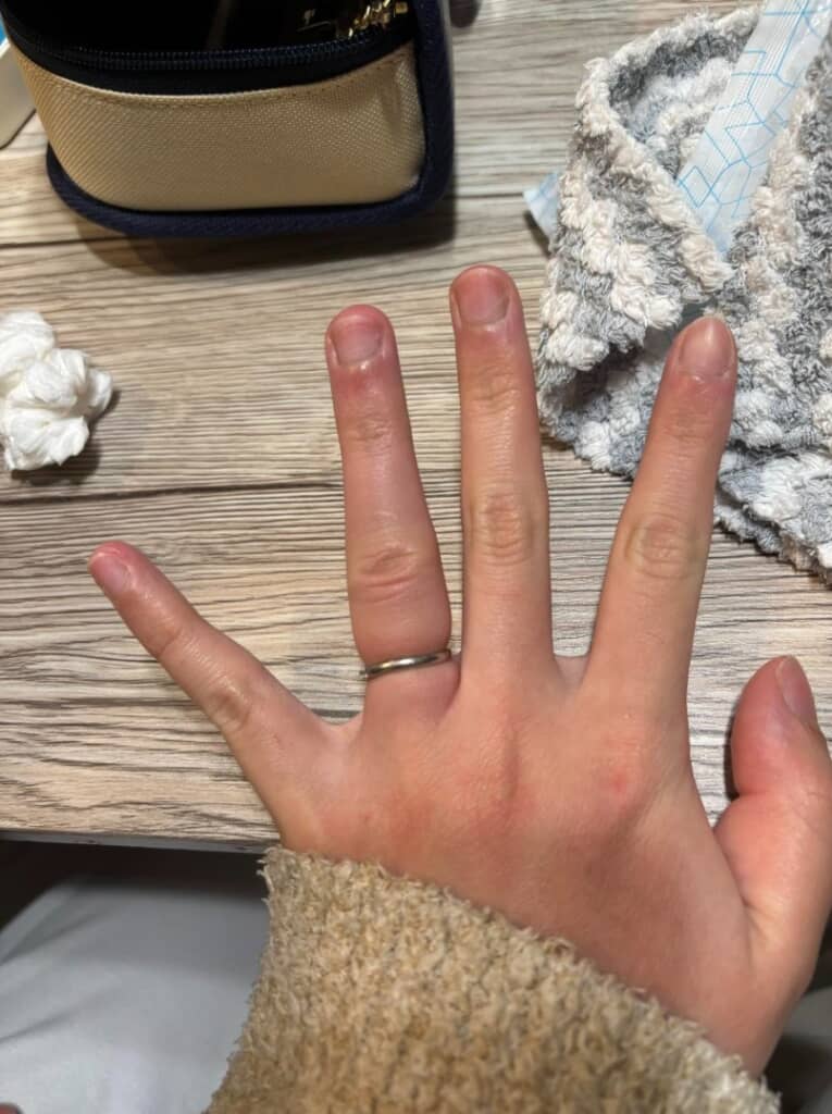 大変なことになってしまいました