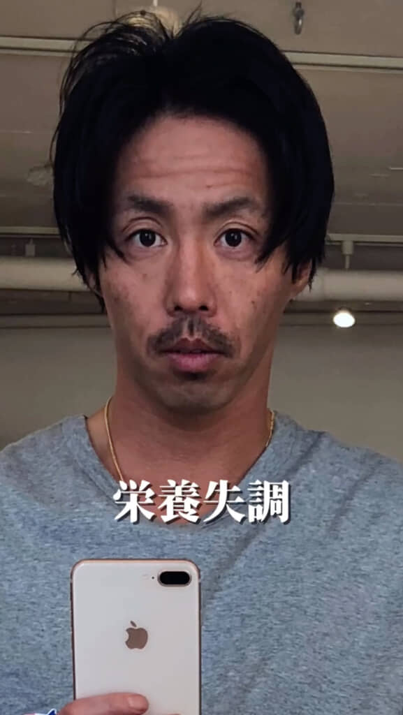 栄養失調で緊急搬送