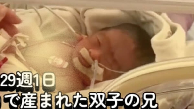 妊娠29週1日、“ほぼ羊水のない状態”で生まれた双子→「生存が難しい」と言われて4カ月後……　“現在の姿”に「たくさん幸せになるんだよ」（1/2） | 育児 ねとらぼ