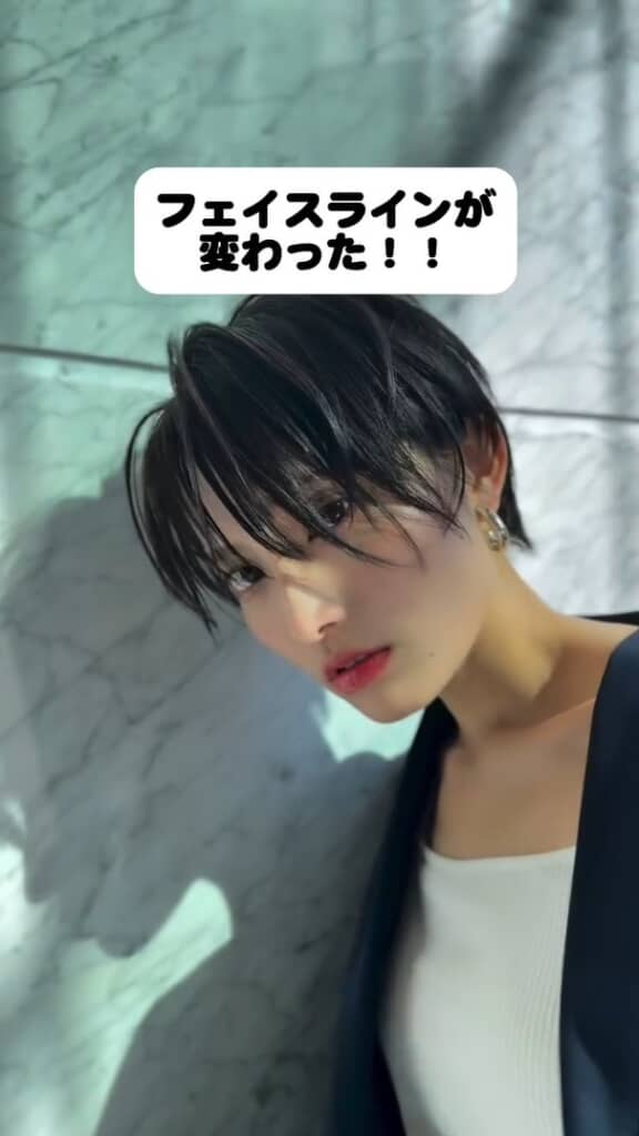 小顔になって、まるで別人のように