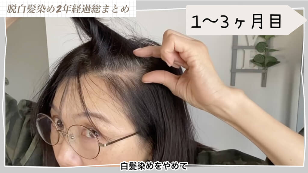 1〜3カ月は白髪が目立ってつらい時期