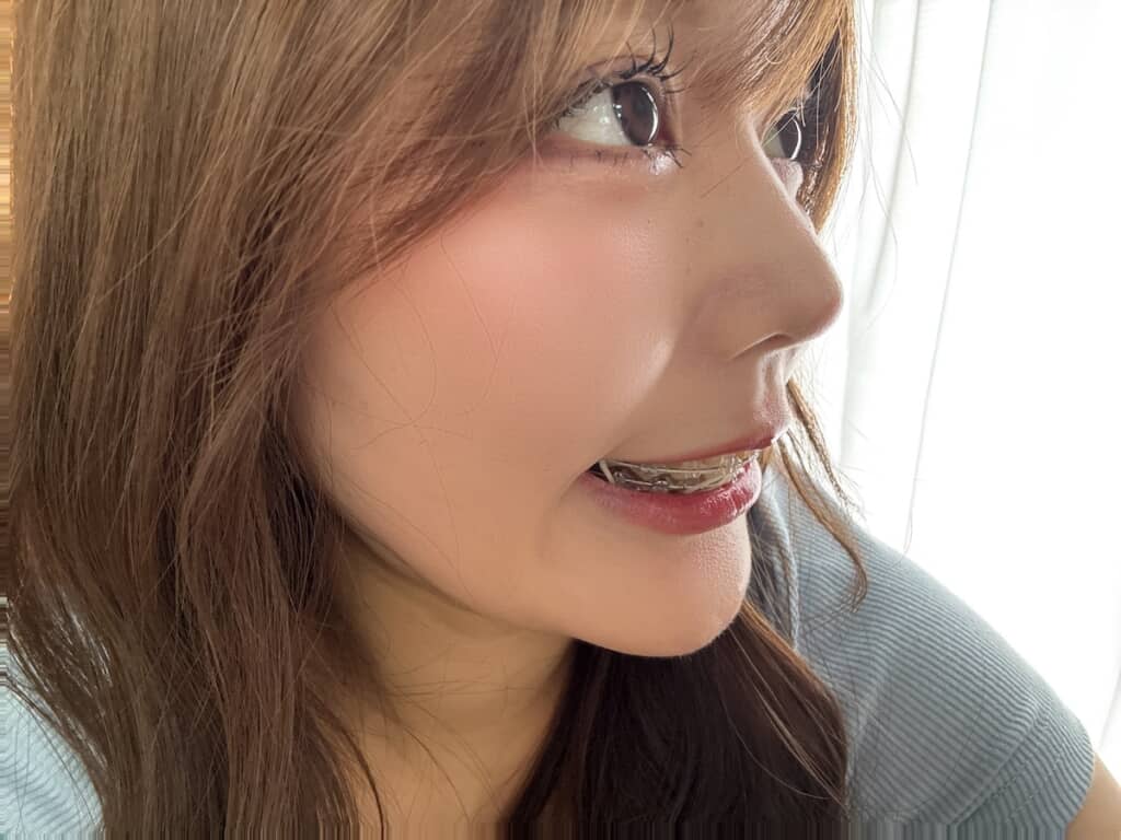 現在のにんにくさん。歯並びがきれいになっただけでなく、ぐっと垢抜けましたね!