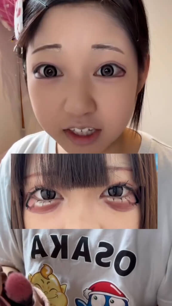 一番変えた涙袋
